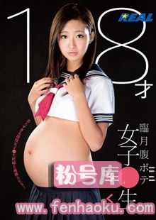 172xrw00201