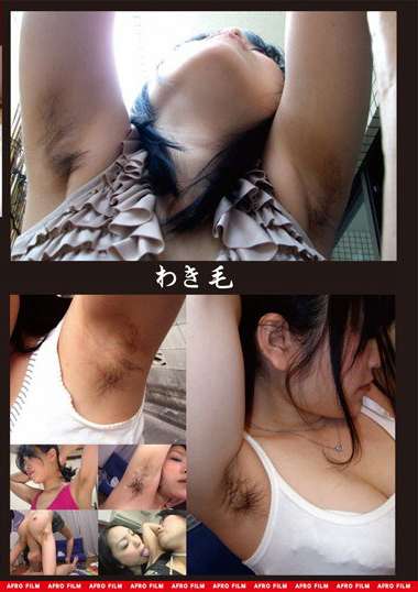 422feti00108