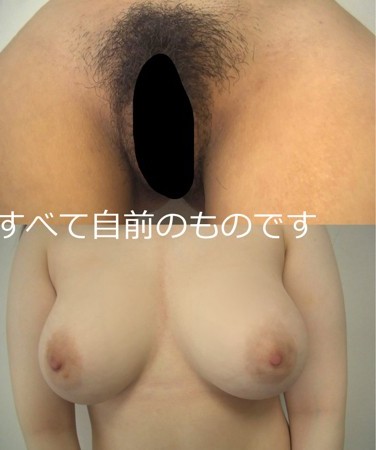 gsanpine001