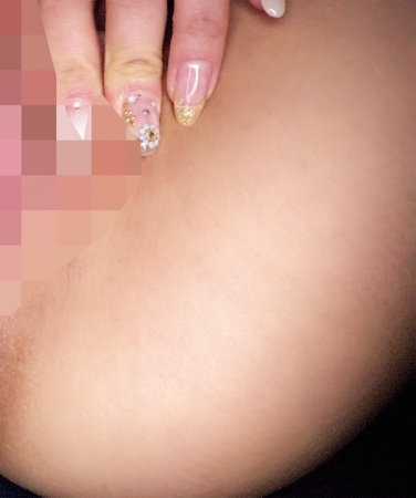 oretda004