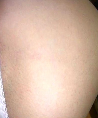 smmc087