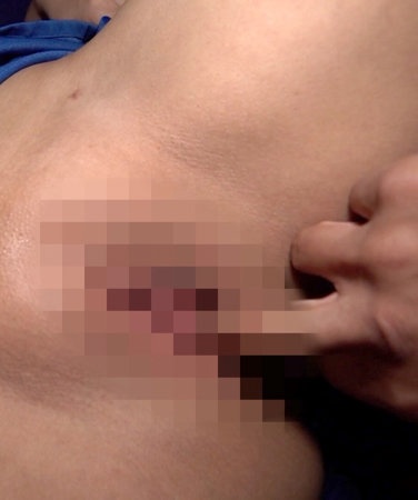 ckj382