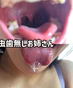 NKO-600003
