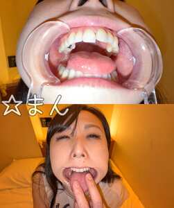 Y-289