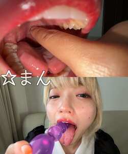 Y-296